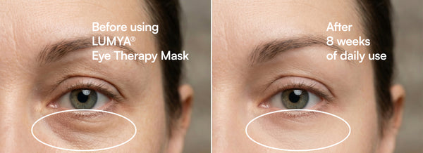 LUMYA® Eye Therapy Mask – Intelligent Heat, Cooling & Targeted Massage for Eye Recovery